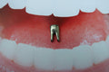 Tooth Lapel Pin